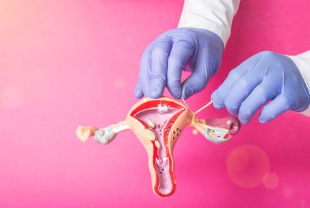 Pagpapatali matapos manganak: Tubal Ligation